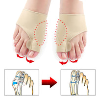 Thumbnail for Toe Corrector