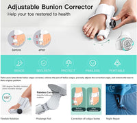 Thumbnail for Big Toe Straightener