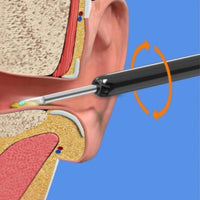 Thumbnail for Wi-Fi visible wax elimination spoon