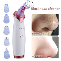 Thumbnail for Remove Blackheads Vacuum Pore Cleaner Pro