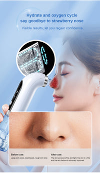 Thumbnail for Water Cycle Pore Acne Pimple Vacuum Removal